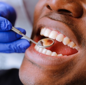 A dentist look at a patient’s teeth using a mirror