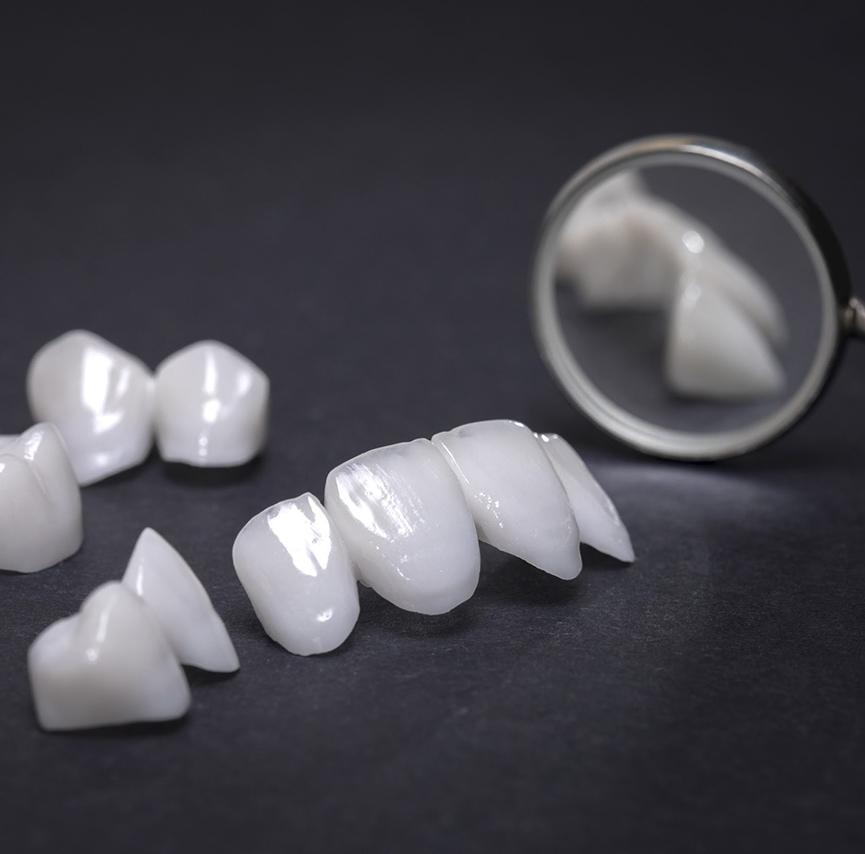 Metal-free dental crowns and bridges on black background