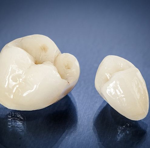 All-ceramic dental crowns on blue background