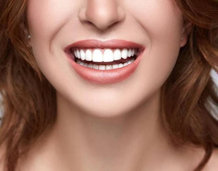 a patient smiling after receiving teeth whitening